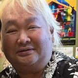 ハチミツ二郎の病気の現在と左足切断の真相を徹底解説