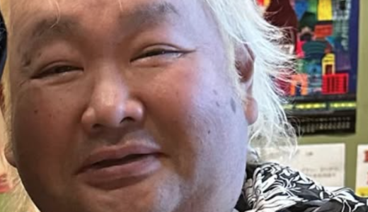 ハチミツ二郎の病気の現在と左足切断の真相を徹底解説