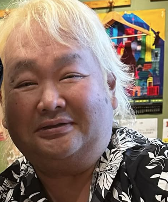 ハチミツ二郎の病気の現在と左足切断の真相を徹底解説