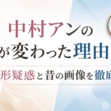 中村アンの顔が変わった理由は?整形疑惑と昔の画像を徹底検証