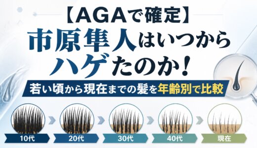 【AGAで確定】市原隼人はいつからハゲたのか！若い頃から現在までの髪を年齢別で比較